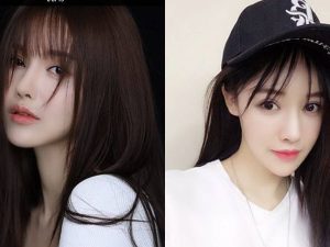Berita selebriti dan gosip artis: artis gagal operasi