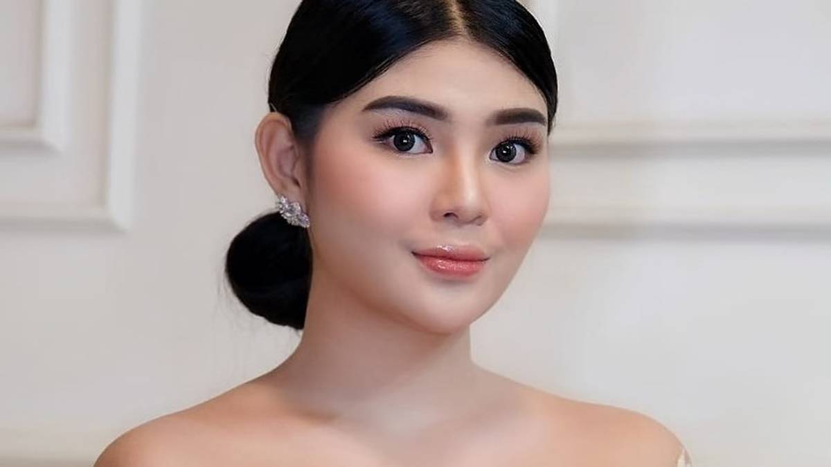 artis gagal operasi plastik