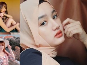 Cekricek.id - Terlihat tidak natural dan tidak alami, artis ini diduga melakukan suntik kulit supaya kulitnya terlihat lebih putih.
