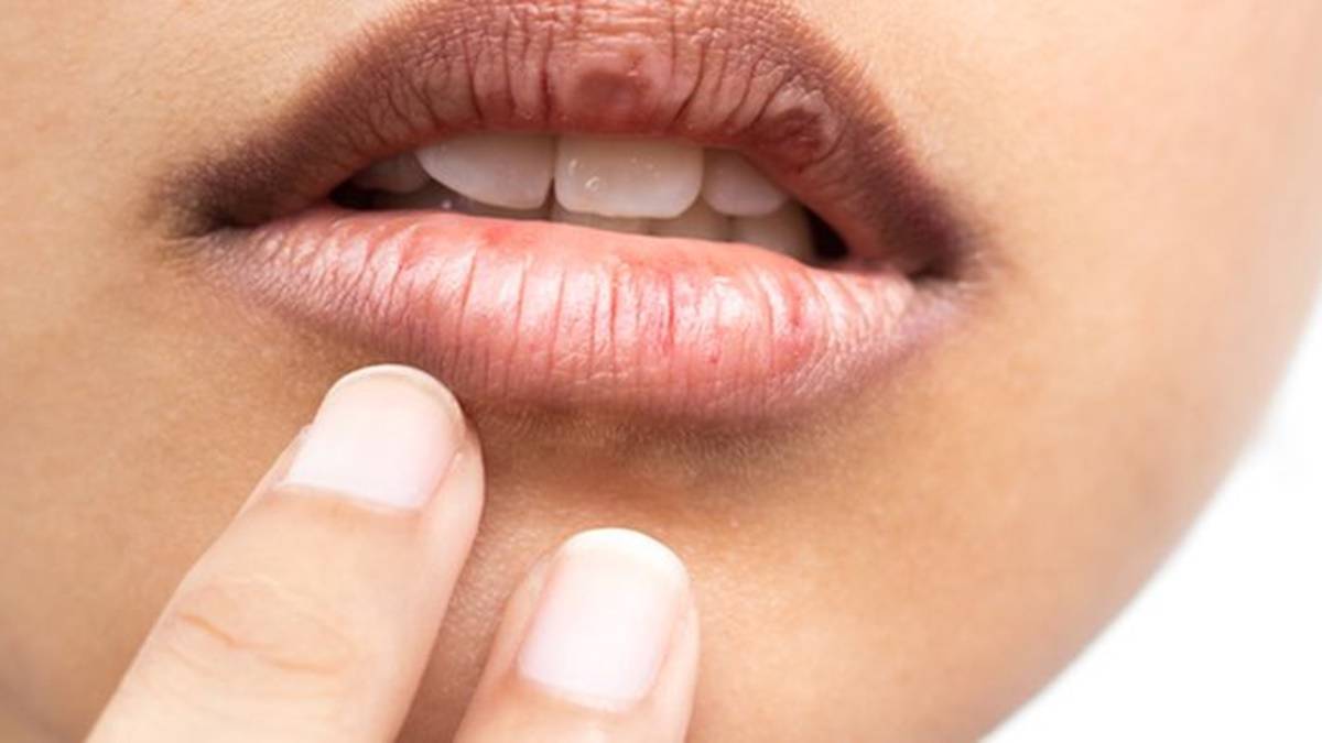 Cekricek.id: Berikut ini cara alami untuk dapat memerahkan bibir yang semula berwarna hitam.