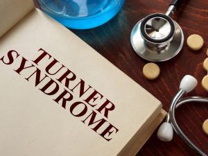Sindrom Turner