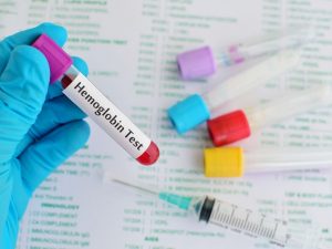 Bahaya Hemoglobin (HB) Rendah, Ini yang Akan Terjadi pada Tubuh Seperti Kelelahan Berlebihan