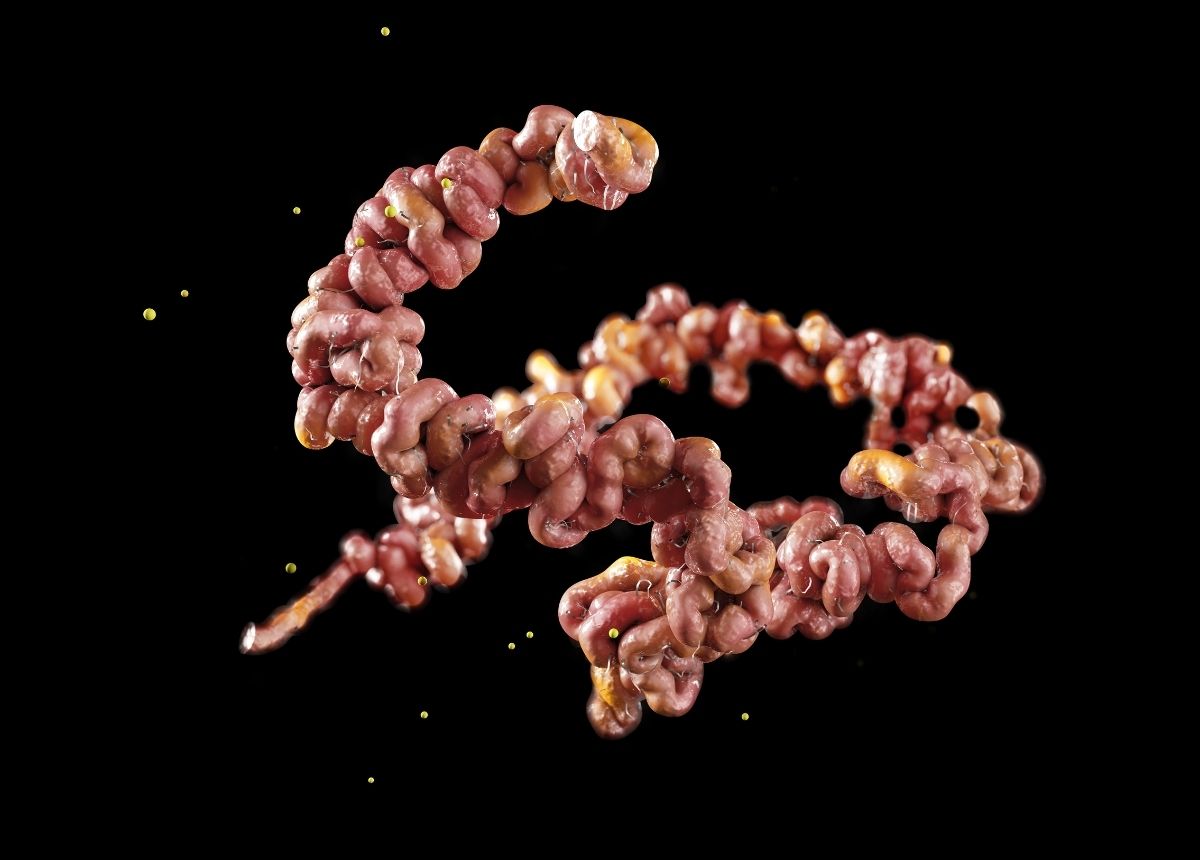 campylobacteriosis