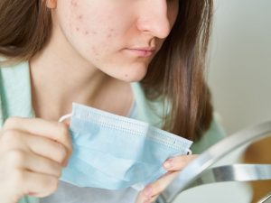 Tips untuk Menghilangkan Komedo