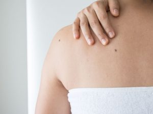 Berita gaya hidup, kesehatan, dan tips terbaru hari ini: 3 bahan alami ini bisa anda digunakan untuk menghilangkan kutil di kulit.