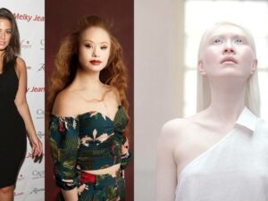 Berita artis, selebriti, dan hot gosip artis terbaru hari ini: model yang sangat unik dan terkenal di dunia serta sukses mendobrak standar kecantikan.