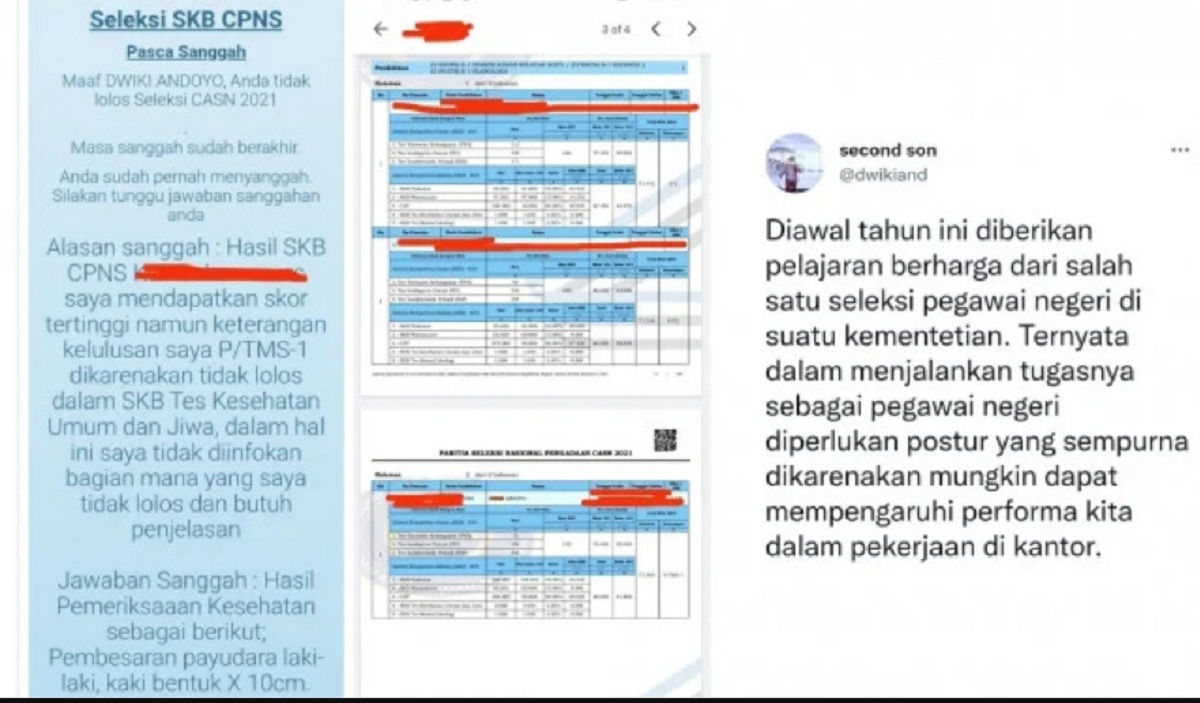 Viral! Peserta CPNS Ini Tidak Lolos Tes Karena Payudaranya Besar Padahal Nilai SKBnya Tertinggi