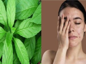 Berita gaya hidup: Siapa sangka, ternyata untuk menghilangkan bekas jerawat tak harus mengeluarkan biaya mahal, cukup dengan mengaplikasikan daun ini.