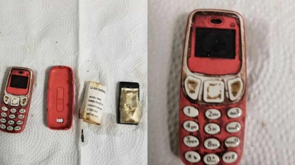 rita viral: Seorang pria telan ponsel Nokia 3310 selama empat hari dan harus mendapat pertolongan medis karena dapat membahayakan hidupnya.