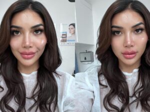 Berita artis: Millen Cyrus melakukan filler countour di wajahnya agar terlihat lebih tirus, bukannya dipuji cantik, netizen malah mengatakan bahwa wajah Millen seram.