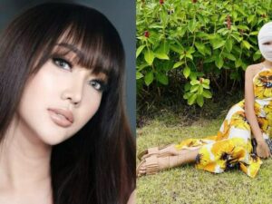 Berita artis: Transgender Lucinta Luna unboxing ‘kepala baru’ usai jalani operasi pada wajah cantiknya, mengaku tak sabar dengan hasilnya.
