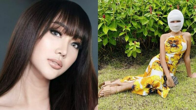 Berita artis: Transgender Lucinta Luna unboxing ‘kepala baru’ usai jalani operasi pada wajah cantiknya, mengaku tak sabar dengan hasilnya.