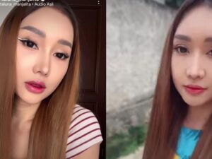 Berita artis: Lucinta Luna ceritakan bagaimana proses operasi plastik di wajahnya, pipi aslinya dipotong dan tengkorak kepalanya dikikis.