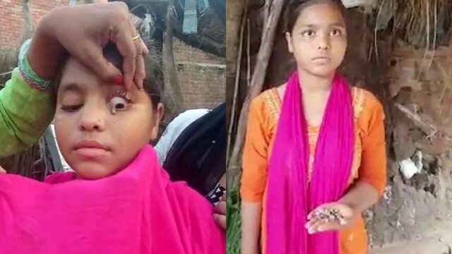 Seorang gadis di India mengeluarkan batu dari mata jika ia menangis. Ha itu membuat dokter bingung melihat melihat fenomena tersebut.