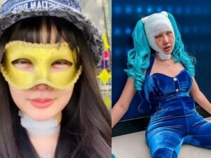 Lucinta Luna beri kabar bahagia, merasa telah sehat usai menjalani sejumlah prosedur operasi. Diantaranya wajah, leher hingga rahim.