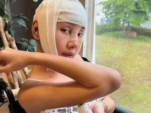 Lucinta Luna mengunggah video dirinya yang terlihat seram, wajahnya terlihat masih lebam usai operasi dan kepalanya masih diperban.