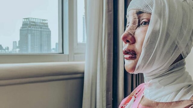 Lucinta Luna kini tengah terbaring di rumah sakit dan tak dapat berbuat banyak karena sedang melakukan operasi pada leher untuk pita suaranya.