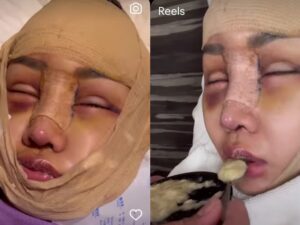 Lucinta Luna curhat betapa susahnya untuk makan usai lakukan operasi di baguah leher dan wajah untuk menjadi wanita yang sempurna, Selasa (12/7/2022).