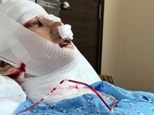 Lucinta Luna baru saja mengunggah potret dirinya yang tengah terbaring di rumah sakit karena malakukan operasi pada lehernya untuk menghilangkan khadar suara prianya.