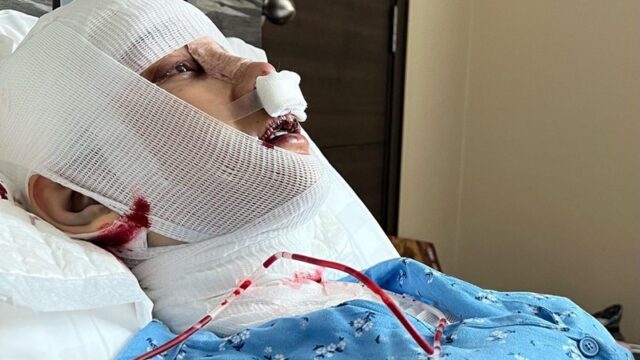 Lucinta Luna baru saja mengunggah potret dirinya yang tengah terbaring di rumah sakit karena malakukan operasi pada lehernya untuk menghilangkan khadar suara prianya.