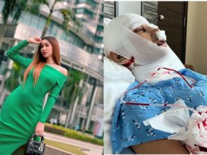 Lucinta Luna membagikan potret dirinya yang terbaring lemah dengan selang infus terpasang dipita suara dan wajah hingga lehernya diperban.