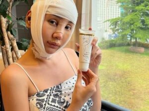 Lucinta Luna dipuji sebagai pekerja keras, karena tetap cari penghasilan lewat endorse dengan kondisi pemulihan pasca operasi.