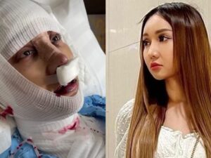 Lucinta Luna curhat bertaruh nyawa rela memotong lehernya demi mendapatkan suara layakya wanita tulen, Kamis (7/7/2022).