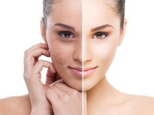 Menjadi glowing merupakan hal yang diinginkan banyak orang, terutama bagi wanita yang terlihat semakin cantik jika sudah glow up.