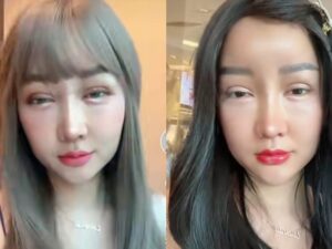Lucinta Luna mengungkapkan bahwa wajahnya memang msih dalam proses penyembuhan sehingga masih bengkak dan terkesan jelek.