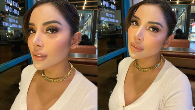 Millen Cyrus disebut cantik yang gak ketulungan usai pamer potret terbarunya dengan dagu yang semakin lancip.
