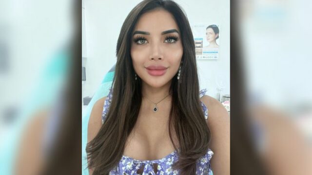 Millen Cyrus dinilai bentuk bibirnya malah semakin dower ketika usai menjalani perawatan kecantikan di salah satu langganannya.