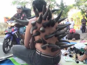 Unik, Bekam Tanduk Kerbau Curi Perhatian Lantaran Buat Pasien Seperti Karakter Bowser Super Mario