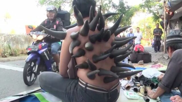 Unik, Bekam Tanduk Kerbau Curi Perhatian Lantaran Buat Pasien Seperti Karakter Bowser Super Mario