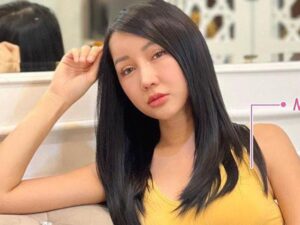 Lucinta Luna menyebut jika wajah cantik usai operasinya itu ditambal dengan daging sapi, ia pun memperlihatkan bekas tambalan daging hewan itu