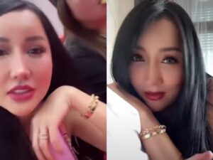 Jidat Lucinta Luna belum lama ini jadi sorotan publik karena terlihat terlalu menonjol dari jidat-jidat wanita umumnya, Kamis (15/9/2022).