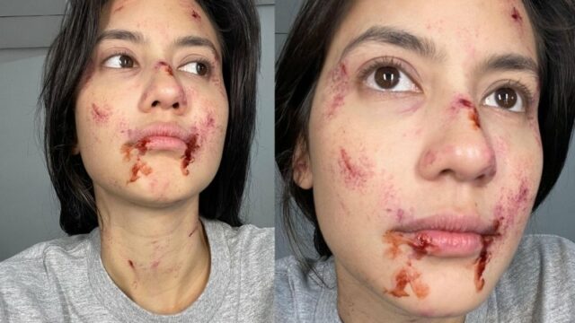 Pevita Pearce memamerkan wajahnya yang penuh dengan darah kering pada unggahan di akun Instagram, Kamis (15/9/2022). Dengan memasang ekspresi sedih, dia malah membuat netizen jatuh hati dan memujinya tetap terlihat cantik dalam keadaan itu.