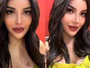 Millen Cyrus hebohkan warganet dengan sebuah bekas merah yang ada du bawah dadanya yang terlihat seperti sebuah bekas kecupan.