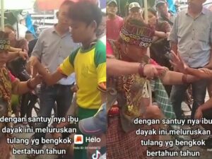 Seorang ibu-ibu viral di media sosial usai berhasil meluruskan tangan seorang laki-laki yang bengkok hanya dalam waktu hitungan detik.