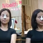 Cekricek.id - Kemunculan Mayang dengan hidung diperban sukses membuat warganet heboh. Adik kandung mendiang Vanessa Angel ini ternyata baru saja menjalani operi plastik pada hidungnya.