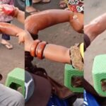 Cekricek.id - Belakangan ini banyak beredar video pengobatan patah tulang yang dilakukan oleh ibu Dayak. Ibu-ibu yang berasal dari Kalimantan Timur itu menyebut dalam sejumlah videonya bahwa dia bisa meluruskan kembali tulang yang bahkan sudah 10 tahun bengkok.