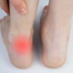 Cekricek.id - Sebenarnya ada beberapa alasan dan penjelasan mengapa kaki tidak berhenti berkedut. Simak penjelasan lengkapnya