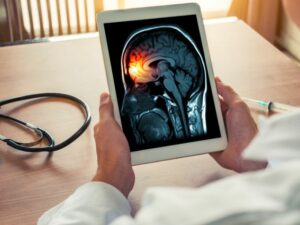 Cekricek.id - Sejak dini sebenarnya setiap orang harus mewaspadai sejumlah gejala meningitis, yuk simak berbagai penjelasan lengkapnya