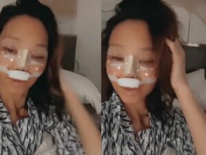 Cekricek.id – Bunda Corla belum lama ini membagikan potret wajanya yang memakai perban di bagian hidung, bagian atas bibirnya hingga lipatan mata. Hal itu membuat warganet berasumsi bahwa dirinya habis menjalankan operasi plastik untuk mengubah bentuk dari penampilan wajahnya itu.