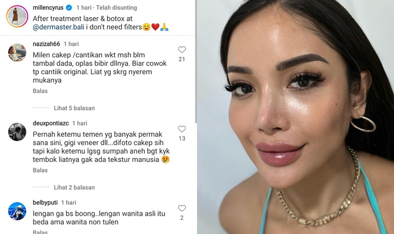 Seksinya Bibir Millen Cyrus, Menggoda Para Followersnya