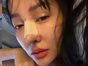 Usai lakukan operasi hidung, wajah Lucinta Luna kembali menjadi sorotan publik di media sosial dan menuai berbagai komentar warganet.