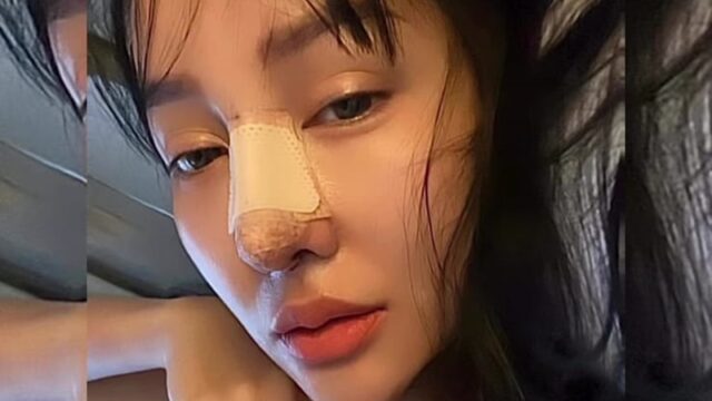 Usai lakukan operasi hidung, wajah Lucinta Luna kembali menjadi sorotan publik di media sosial dan menuai berbagai komentar warganet.