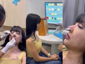 Cekricek.id - Bentuk tampilan baru dari hidung seorang Lucinta Luna dianggap udah sempurna. Kini tidak ada lagi julukan Pinokio yang ia dapatkan