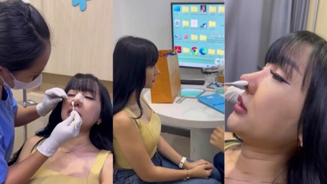 Cekricek.id - Bentuk tampilan baru dari hidung seorang Lucinta Luna dianggap udah sempurna. Kini tidak ada lagi julukan Pinokio yang ia dapatkan