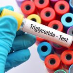 Cekricek.id - Kurangnya pengetahuan terkadang membuat seseorang sulit untuk membedakan antara trigliserida dengan kolestero