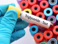 Cekricek.id - Kurangnya pengetahuan terkadang membuat seseorang sulit untuk membedakan antara trigliserida dengan kolestero